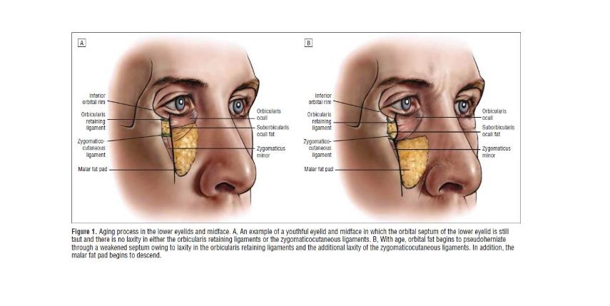 眼周抗衰的关键在于,眼周抗衰一般打几支胶原蛋白