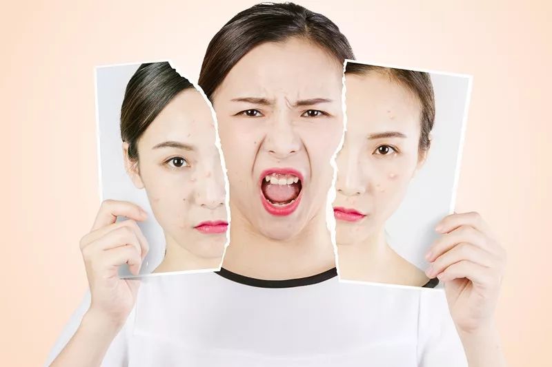 茉莉补水保湿纯露,补水纯露湿敷水推荐