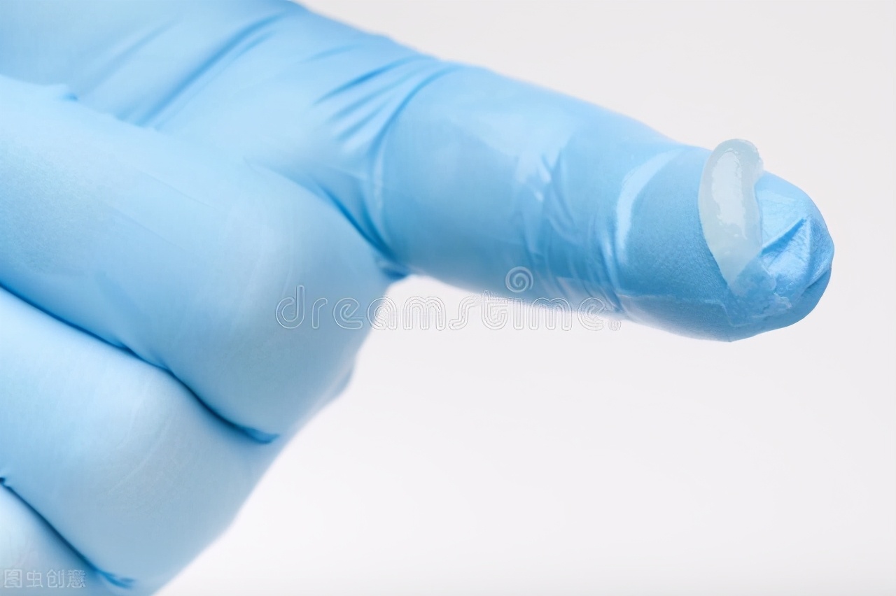 痔疮如何治疗效果最好,挑筋治疗痔疮