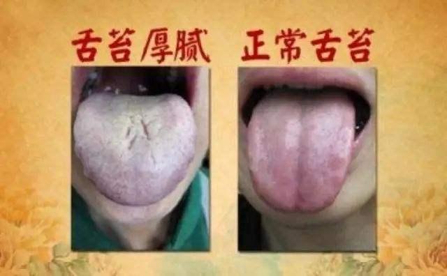 感冒咳嗽气短胸闷上不来气,特殊时期咳嗽了怎么办