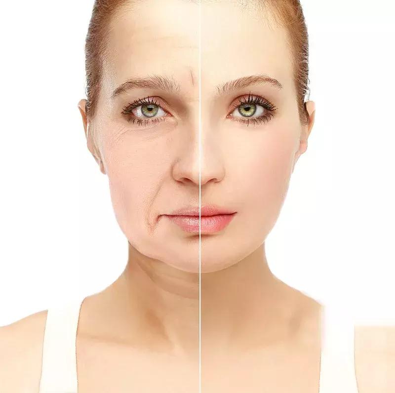 目前去颈纹比较好的方法,去颈纹有没有什么好的产品