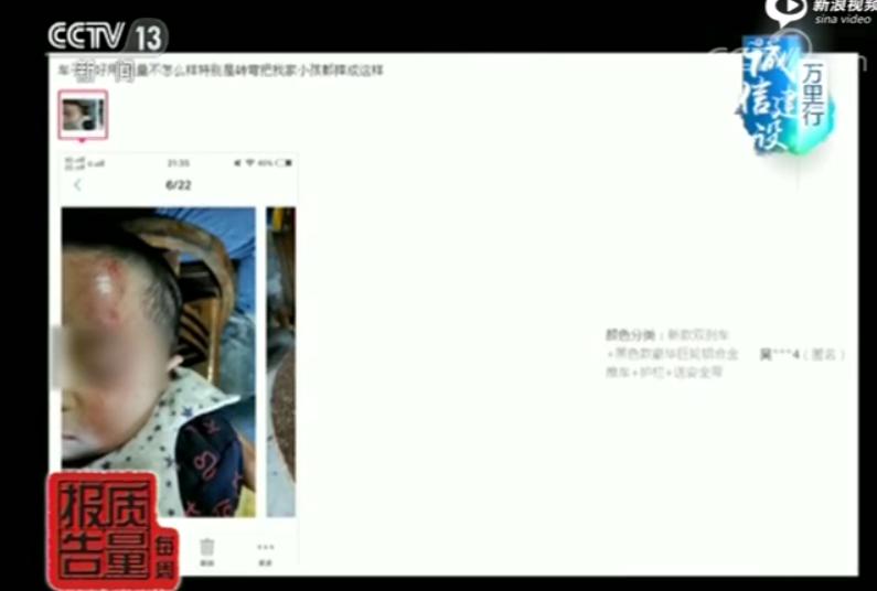 网红眼药水危害,网红眼药水值不值得买