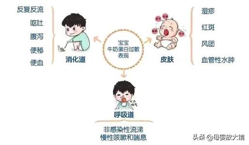 羊奶粉容易导致宝宝过敏吗,牛奶蛋白过敏宝宝适合哪种羊奶粉