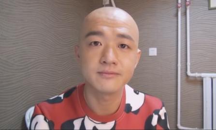 高晓松烟疤,高晓松手臂的烟疤