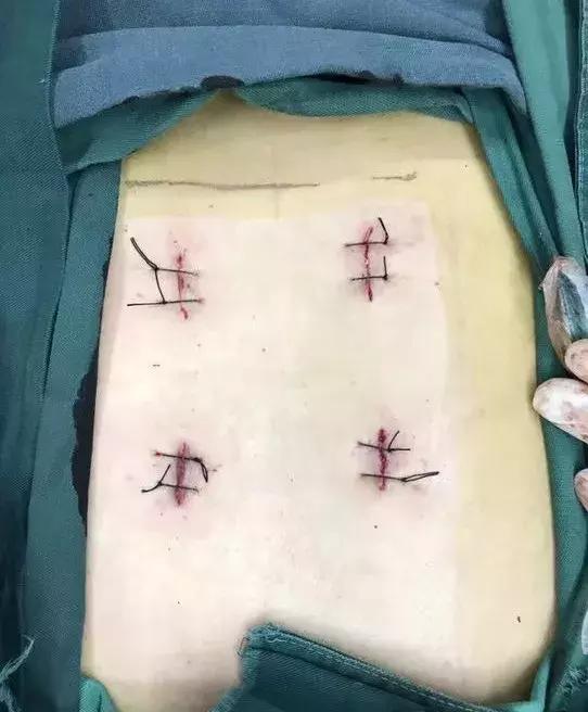 锦州发明专利,锦州实用新型专利