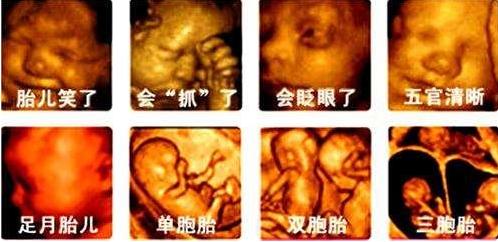 澶╂墠鑳庡効瀹岀粨,澶╂墠鑳庡効