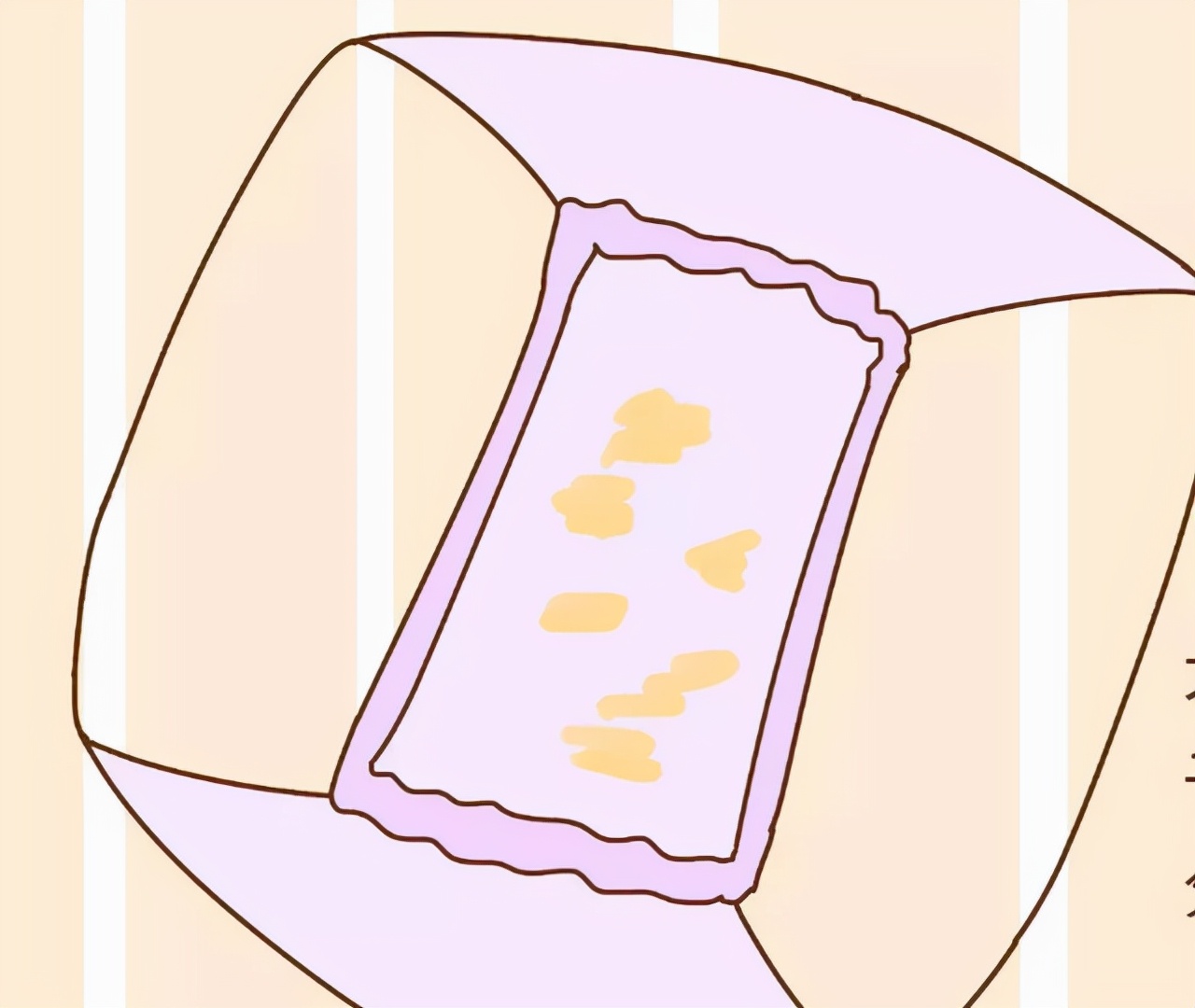 裤衩老有黄色分泌物是怎么回事,女裤有血丝怎么回事