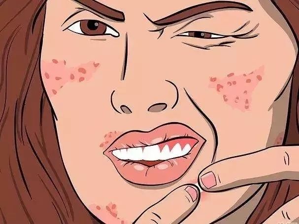 疮的原因和治疗方法,疮什么原因引起的