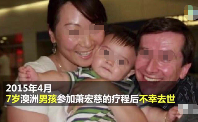 拍打拉筋治强直性脊柱炎成功案例,拍打拉筋治病视频