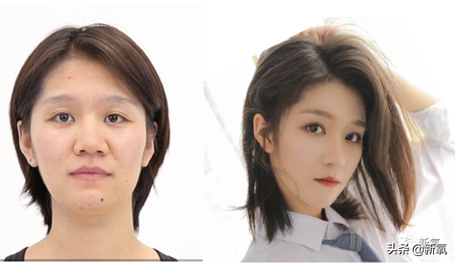 村姑整成鞠婧祎的鼻子变天使,鞠婧祎的鼻子整过吗