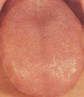 又上火了怎么回复,急火上火