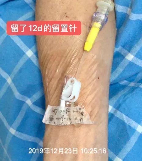 病人拒绝治疗护士怎么办,患者拒绝打留置针可以吗