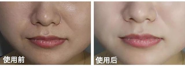 大长今宋慧乔金喜善,大长今金喜善宋慧乔