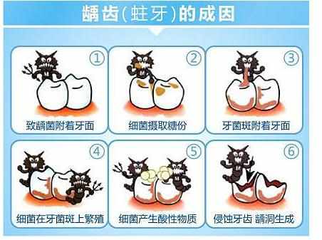 牙齿变黑刷不掉是蛀牙吗,牙齿变黑还能医好吗