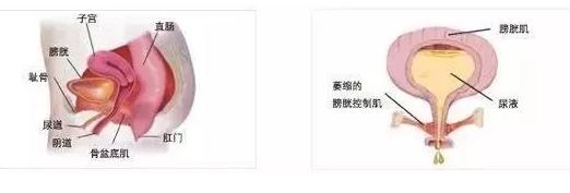 产后骨盆修复有必要吗？如何产后骨盆修复？