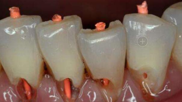 教你正确的刷牙方式牙齿越刷越白,为什么天天刷牙牙齿还是刷不干净