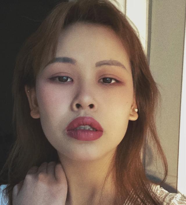 嘴唇厚黑怎么改善,嘴唇很厚而且还翘怎么办