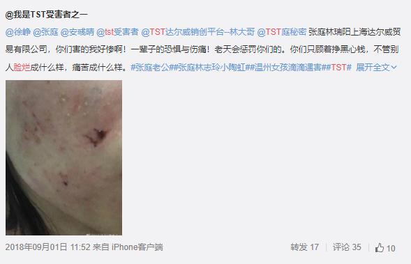 日赚数亿却直播哭穷，揭幕张庭、林瑞阳的商业帝国