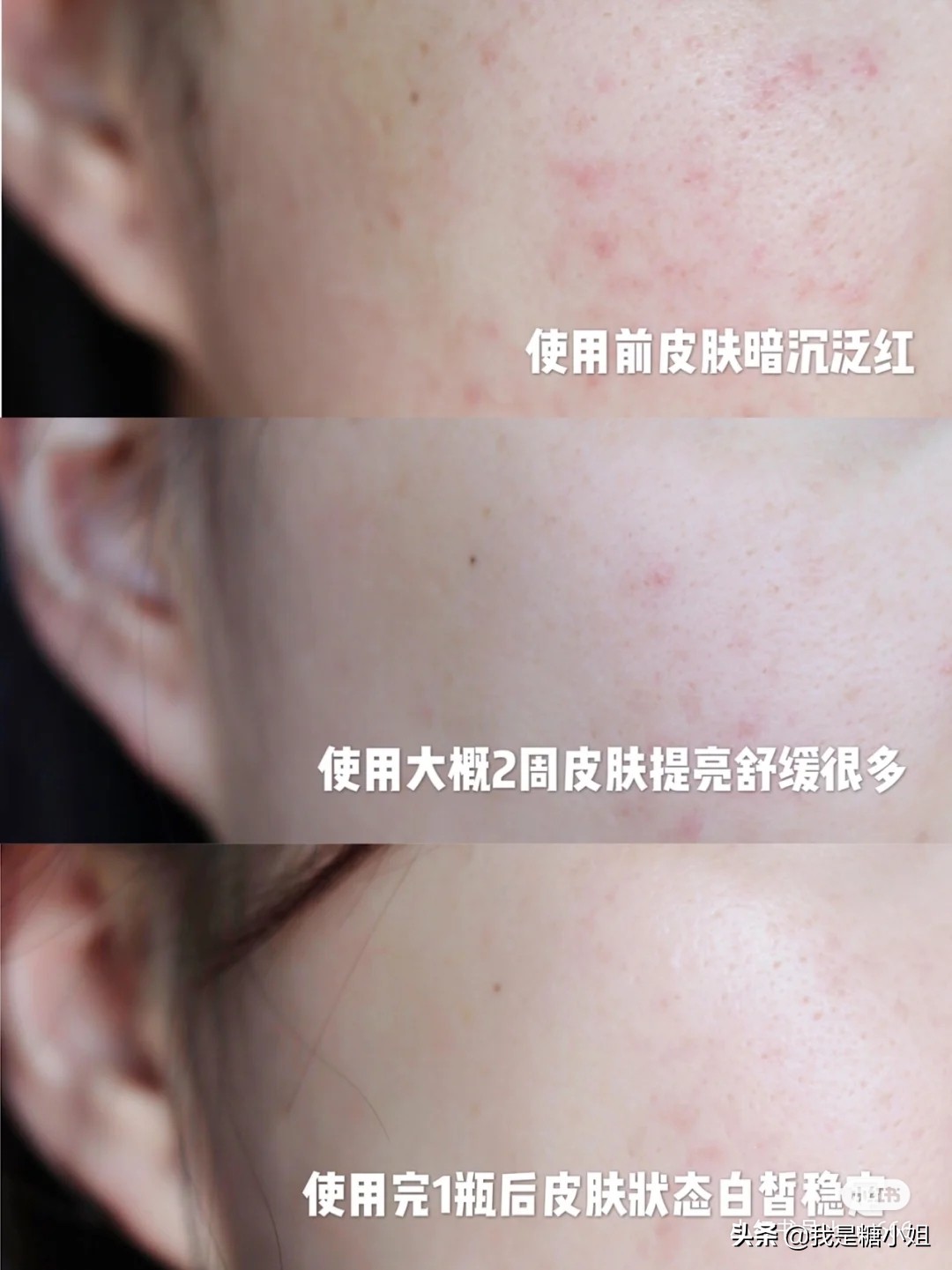 即时美白是真的吗,即时美白的真正原因