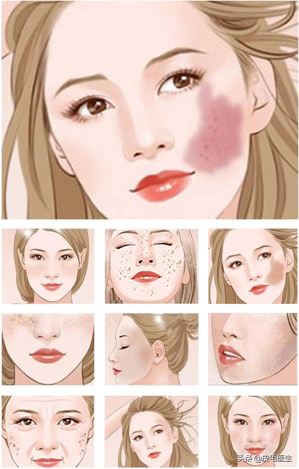 褐斑祛斑最有效方法,年轻人脸上长褐斑老年斑如何治疗