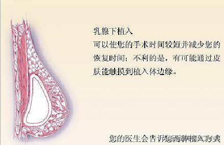 18岁女可以练胸吗,基础太差做胸部整形