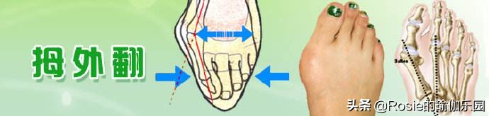 膝盖疼穿高跟鞋反倒好些了,穿高跟鞋是否会对踝关节有影响