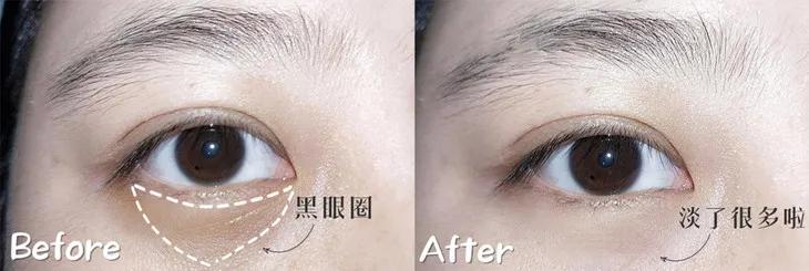 “38岁的年纪,18岁的脸”:能保持年轻的女人,手里少不了它