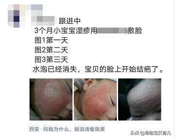 一擦就好？别被骗了！湿疹膏这样选、这样用才靠谱！