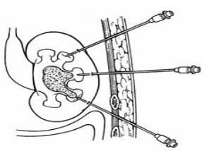 山东治疗泌尿外科比较好的医院,山东大学附属医院泌尿外科专家
