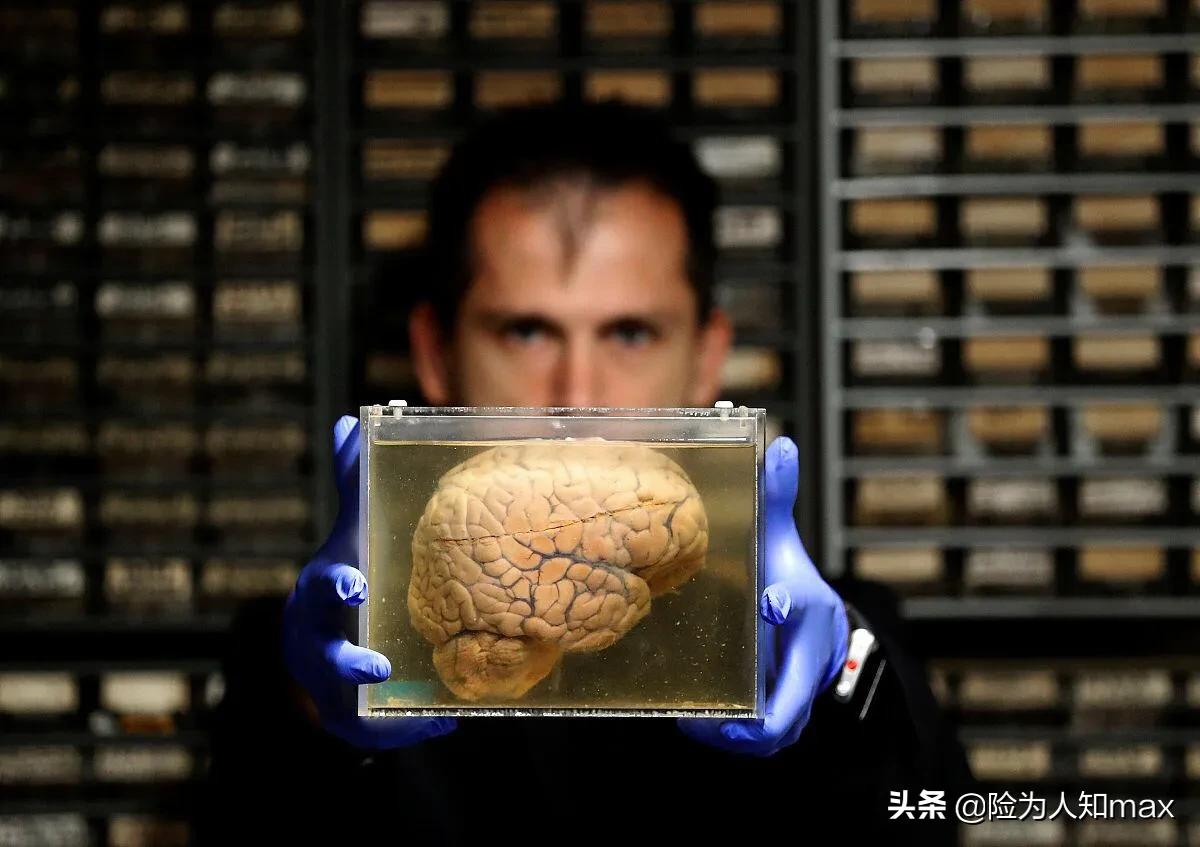 38岁男子痴呆晚期表现有哪些,年轻人得了痴呆症状