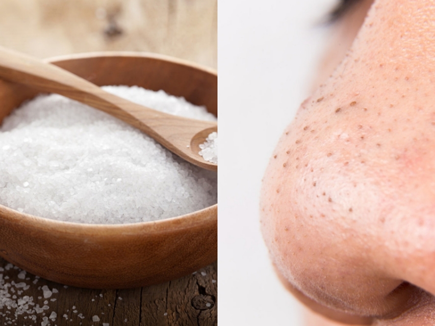 怎样去黑头最有效的土方法,如何正确去黑头的土方法