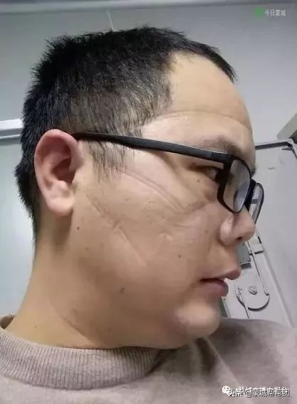 离病毒最近的疾控人,离病毒最近的疾控工作者