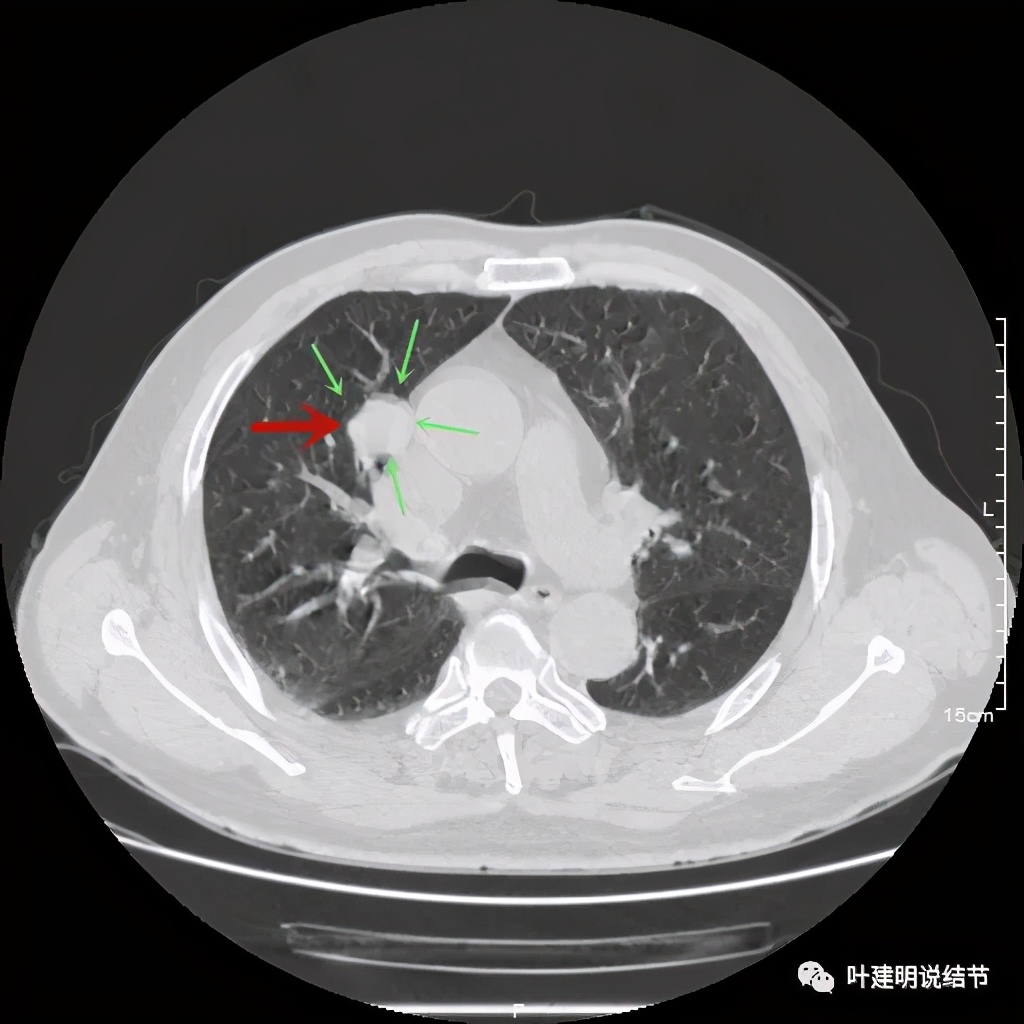 误诊报告图片,误诊案例及案例分析