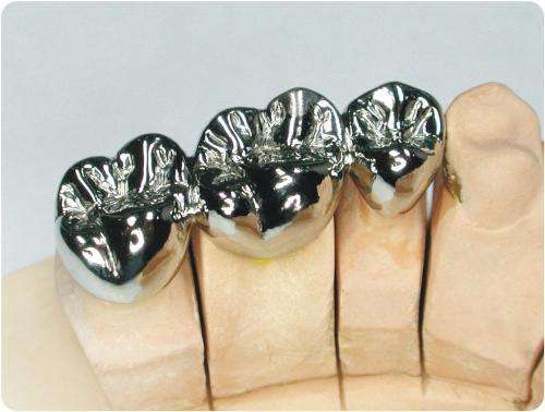 牙冠的常见种类与区别,牙冠什么种类性价比高