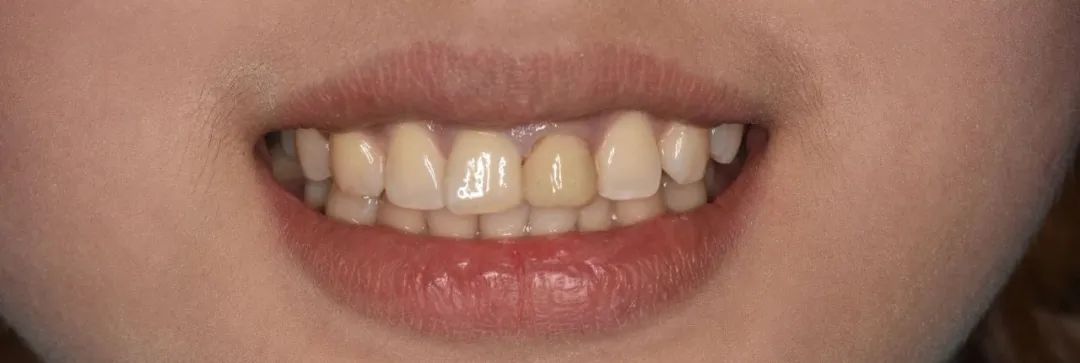 美白牙膏去牙黄真实有效测评,美白牙膏真实测评护牙效果