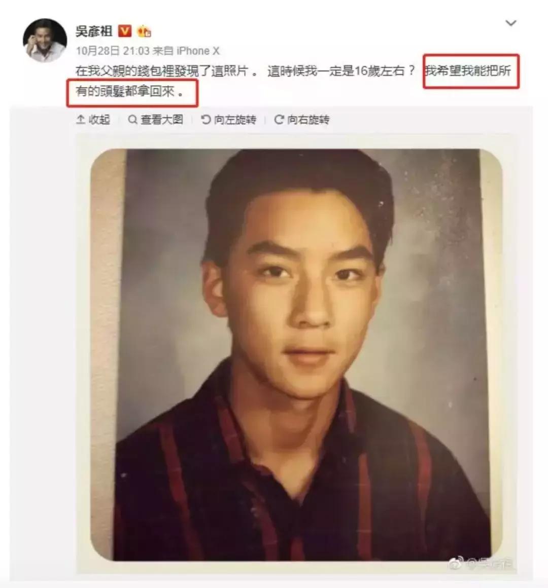 岛国这款生发神器，让你一言不合就长成热带雨林