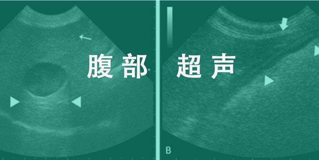 妇产超声科检查什么,妇产科检查超声一般是有什么问题