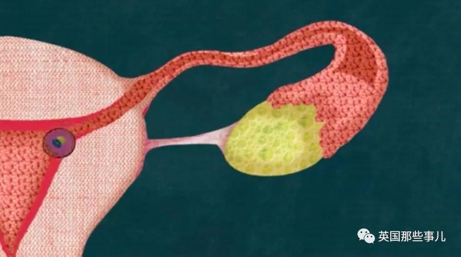 月经对女人的意义与作用,月经的作用和好处有哪些