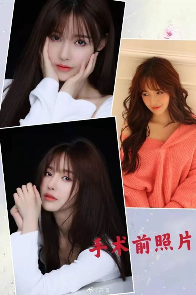 女明星整容失败案例电视剧,盘点那些整容失败案例的女演员