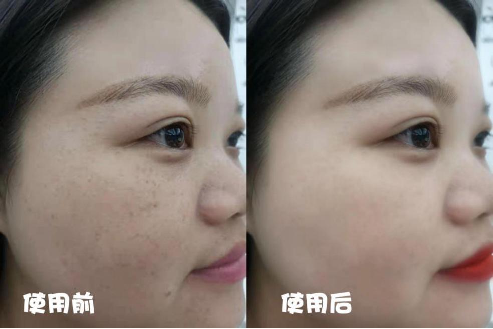 公认最好用的10大面膜国货图片,国货面膜补水淡斑美白