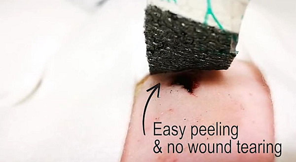 医用防粘连纱布,医用即溶止血纱布图片