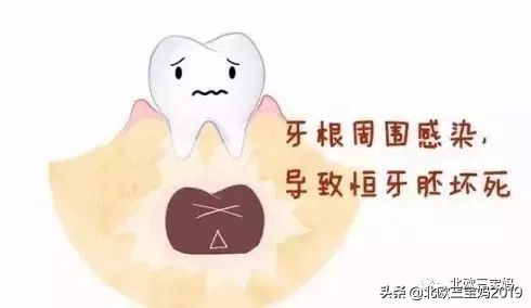 3岁儿童全麻做根管有影响吗,宝宝捆绑治疗蛀牙