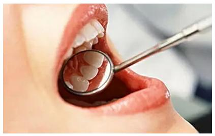 口服维生素c有美白作用么,补充维生素美白真的吗