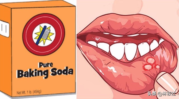 日常生活中的小苏打,最新生活小窍门小苏打