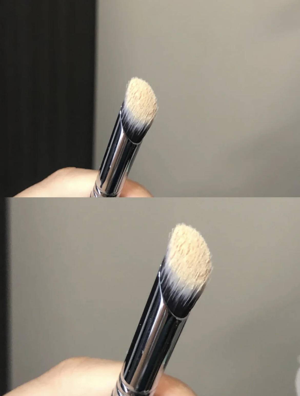 严重泪沟黑眼圈,淡化黑眼圈和泪沟原理