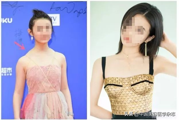 平胸女孩有什么特征,平胸女孩也能穿出高级感