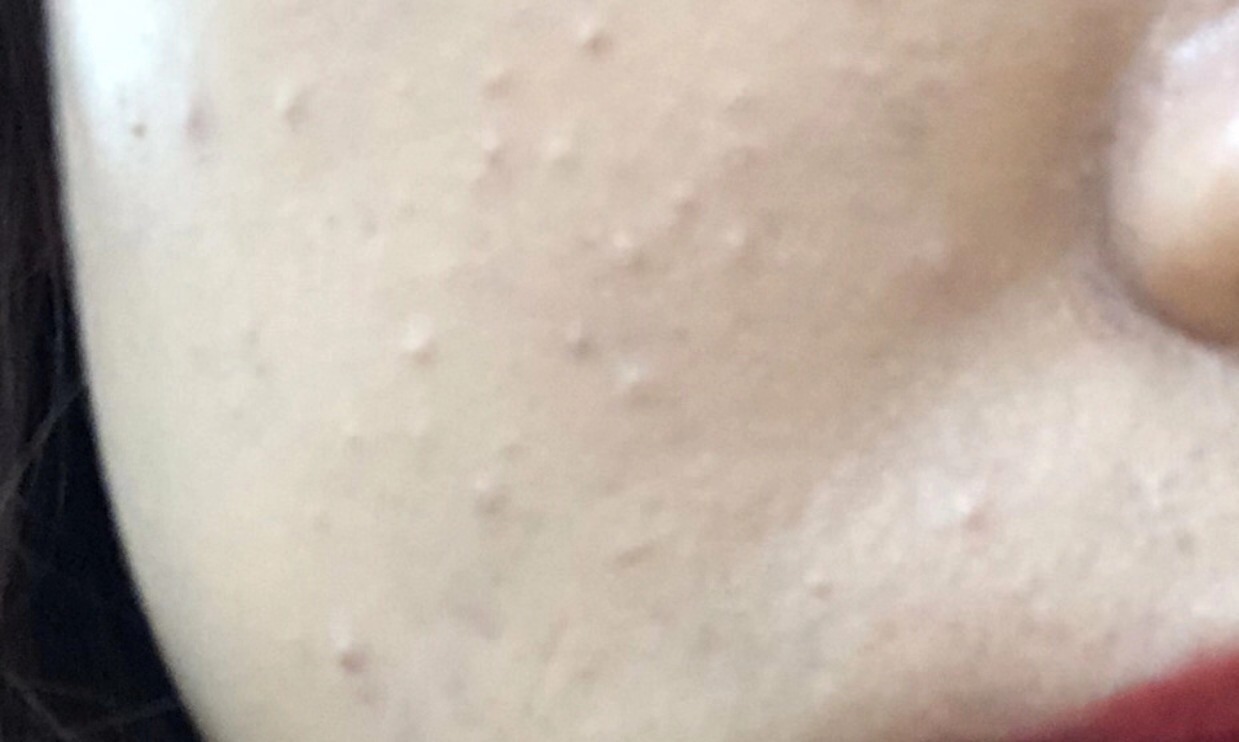 你知道什么是闭口吗,闭口和不是闭口