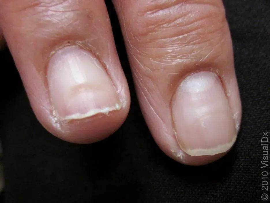 想让指甲长得快些怎么办,想让指甲变好看怎么办