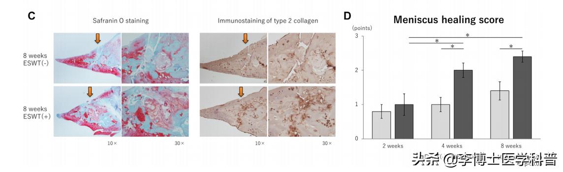 体外冲击波治疗半月板损伤国际最新研究成果报道
