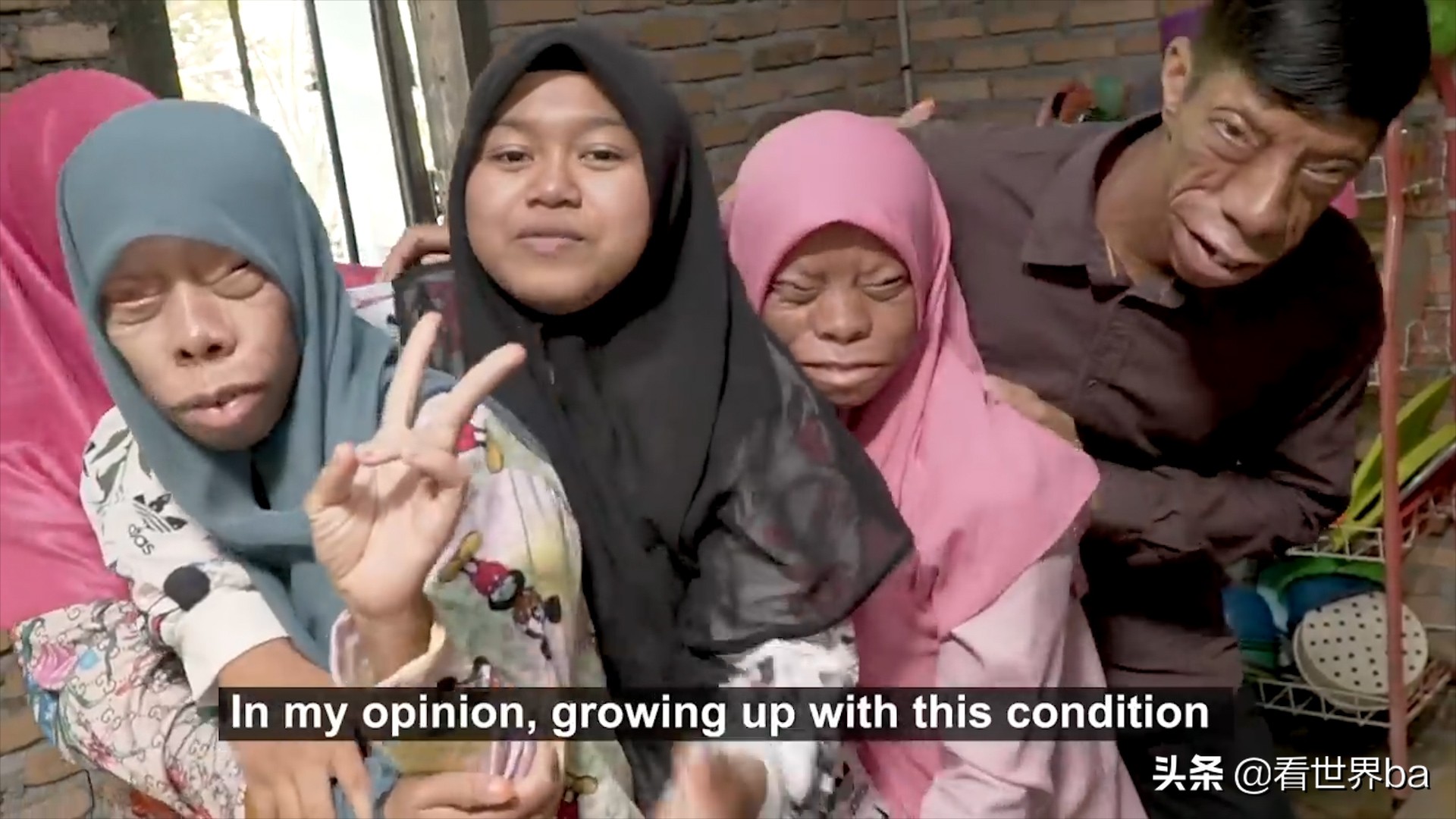 印尼家族怪脸,印尼怪病